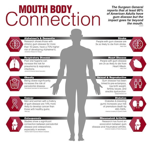 Mouth body connection