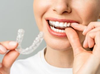 Achieving Overall Wellness With Invisalign At Monahan Dental And Implant Center